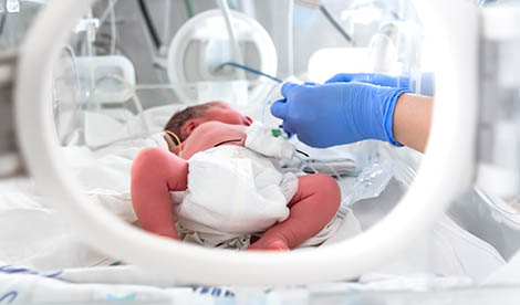 Neonatal care